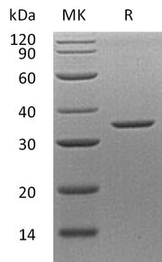 Recombinant Human ANXA8