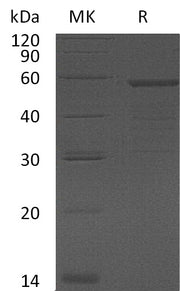 Recombinant Human GAS-7 (N-6His)