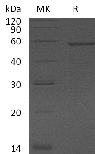 Recombinant Human GAS-7 (N-6His)