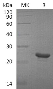 Recombinant Human FGF-21 (N-6His)