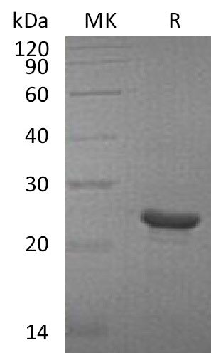 Recombinant Human FGF-21 (N-6His)