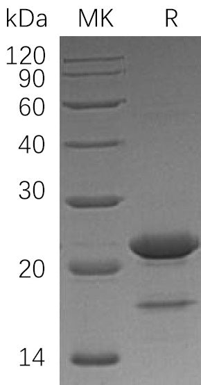 Recombinant Human ZBTB17 (N-6His)