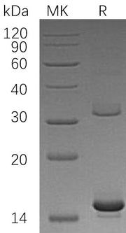 Recombinant Human HBAZ (N-6His)