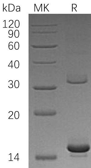 Recombinant Human HBAZ (N-6His)