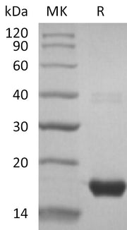 Recombinant Human GGACT (N-6His)