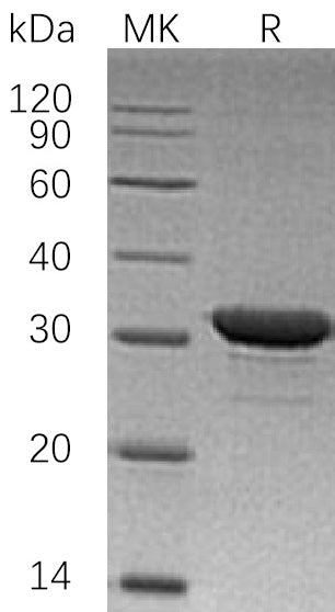 Recombinant Human IMPase1 (N-6His)