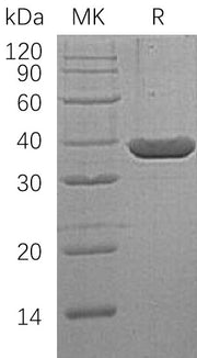Recombinant Human LDH-A (N-6His)