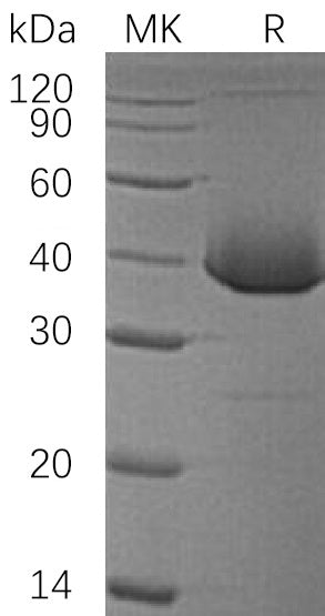 Recombinant Human LDH-B (N-6His)