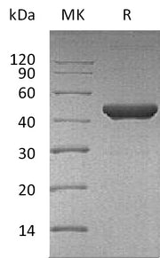 Recombinant Human Fumarase