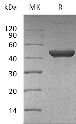 Recombinant Human Fumarase