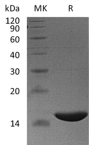 Recombinant Human FABP6 (N-6His)