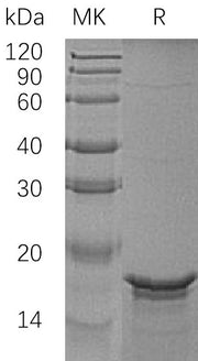 Recombinant Human GFAP (N-6His)