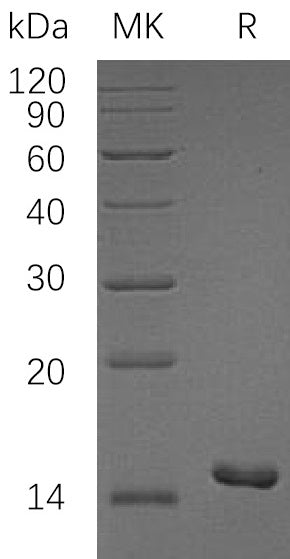Recombinant Human PKI-Beta (N-6His)