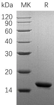 Recombinant Human OM (N-6His)