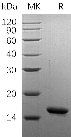 Recombinant Human OM (N-6His)
