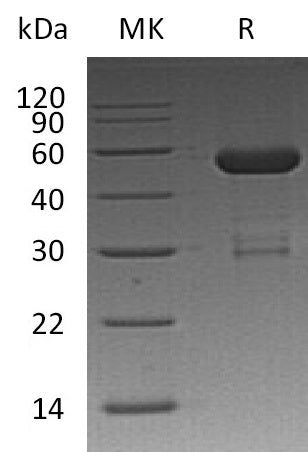 Recombinant Human OTUB2 (N-GST)