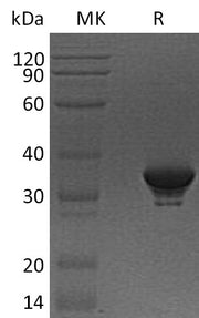 Recombinant Human QPRTase (N-6His)