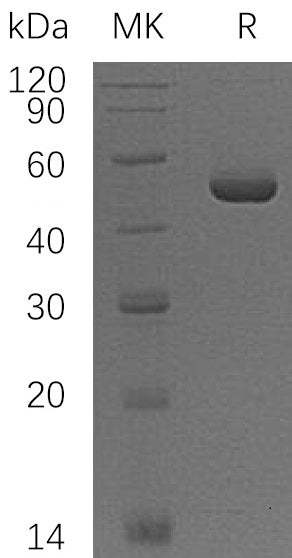 Recombinant Human PMM1 (C-6His)