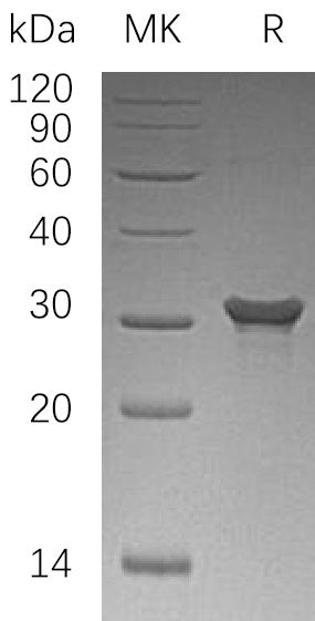 Recombinant Human PAFAHB (C-6His)
