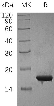 Recombinant Human CDKN2C (N-6His)