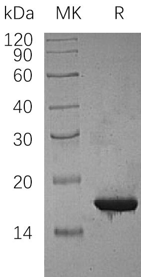 Recombinant Human CDKN2C (N-6His)