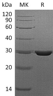 Recombinant Human PMM2 (C-6His)