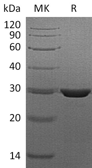Recombinant Human PMM2 (C-6His)