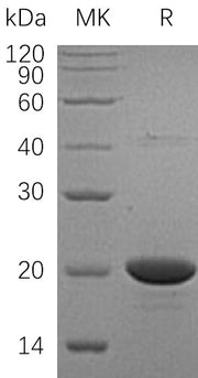 Recombinant Human NDPKA (N-6His)