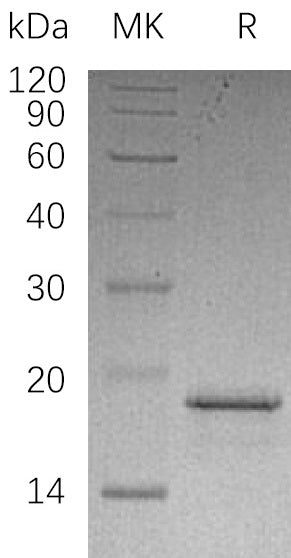 Recombinant Human PFDN2 (N-6His)