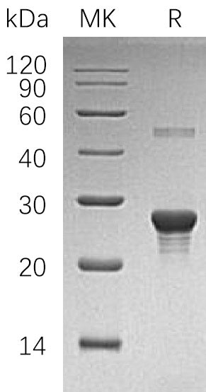 Recombinant Human PPC-DC (N-6His)