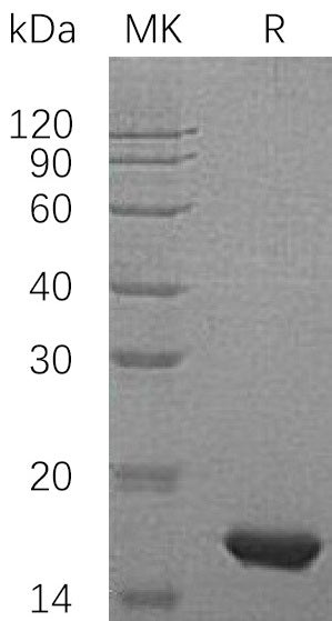 Recombinant Human PMP2 (N-6His)