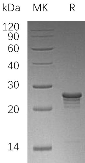 Recombinant Human PMVK (N-6His)
