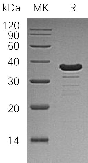 Recombinant Human GALE (N-6His)