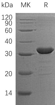 Recombinant Human CLIC2 (N-6His)