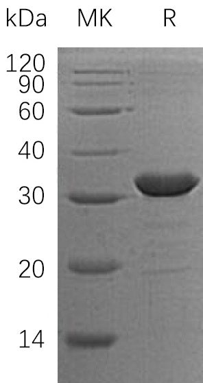 Recombinant Human CLIC2 (N-6His)