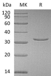 Recombinant Human VSNL1 (N-6His)