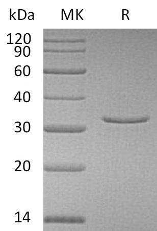 Recombinant Human VSNL1 (N-6His)