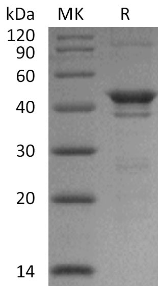 Recombinant Human NADK (N-6His)