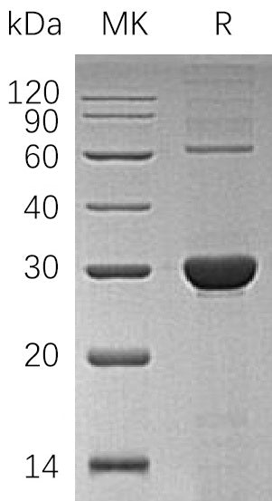Recombinant Human UROIIIS (C-6His)