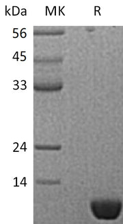 Recombinant Human S100P (N-6His)