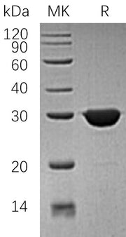 Recombinant Human TIM (N-6His)