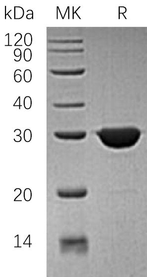 Recombinant Human TIM (N-6His)