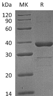 Recombinant Human ZWINT (N-6His)