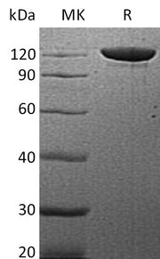 Recombinant Human Vinculin