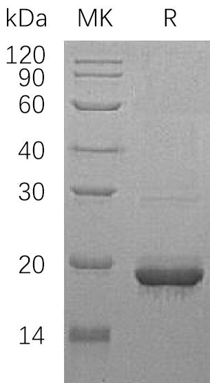 Recombinant Human SCO1 (N-GST)