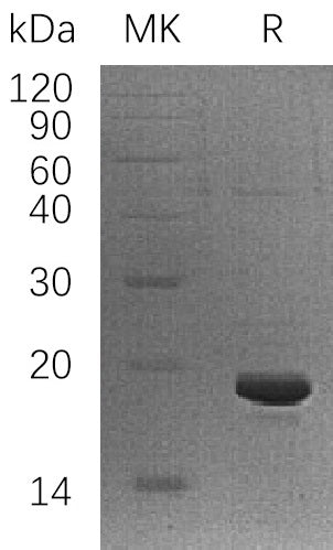 Recombinant Human LSM1 (C-6His)