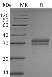 Recombinant Human VSIG2 (C-6His)