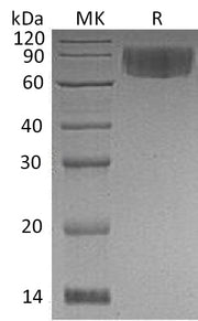 Recombinant Human VNN1 (C-6His)