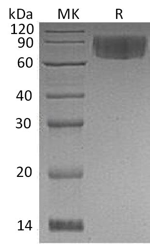 Recombinant Human VNN1 (C-6His)