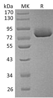 Recombinant Human SPP1 (C-6His)